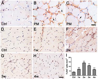 Toll-Like Receptor 4–Myeloid Differentiation Primary Response Gene 88 Pathway Is Involved in the Inflammatory Development of Polymyositis by Mediating Interferon-γ and Interleukin-17A in Humans and Experimental Autoimmune Myositis Mouse Model